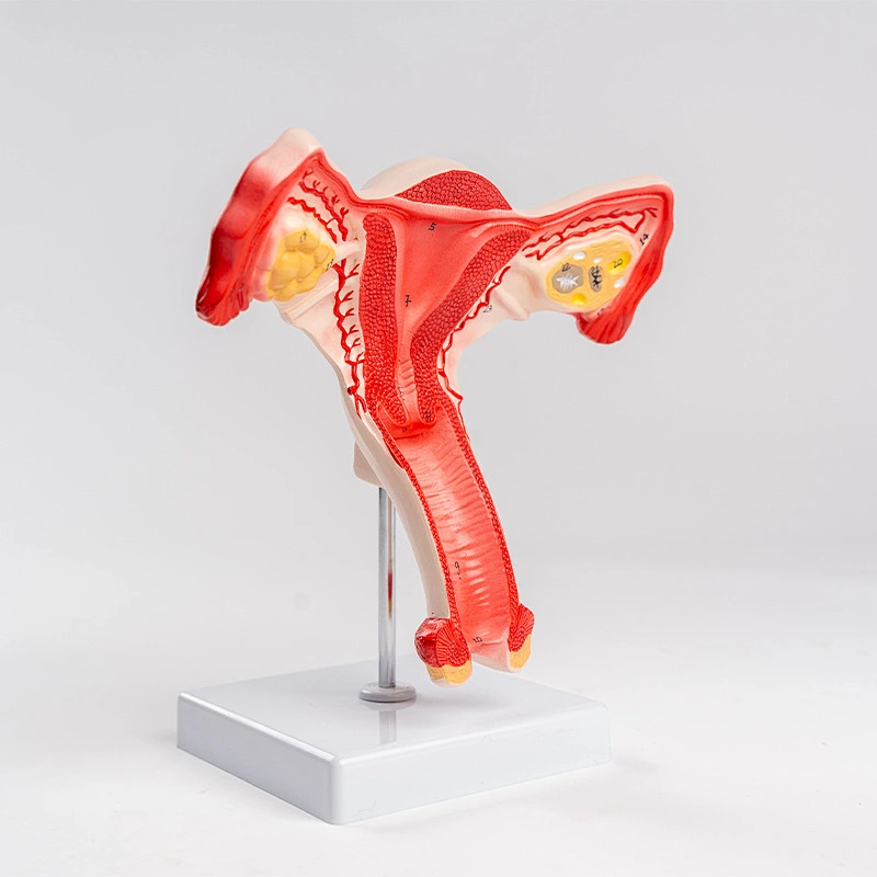 Normal uterus model