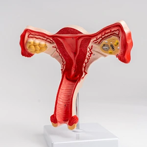 Normal uterus model