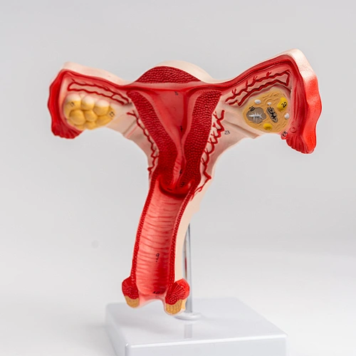 Normal uterus model